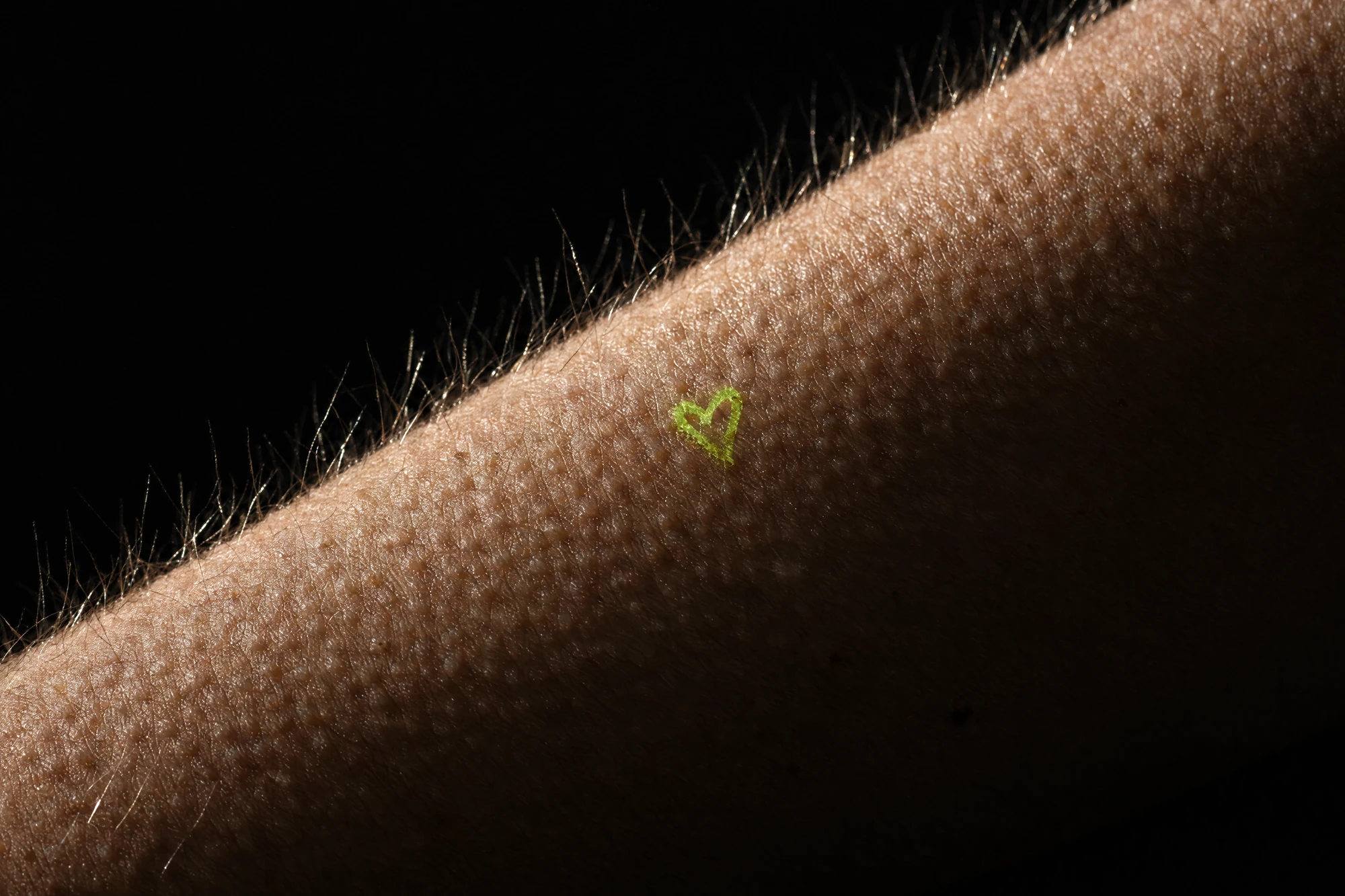 Macro van kippenvel op een onderarm met een klein neon hartje